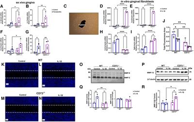 The protective role of CD73 in periodontitis: preventing hyper-inflammatory fibroblasts and driving osteoclast energy metabolism